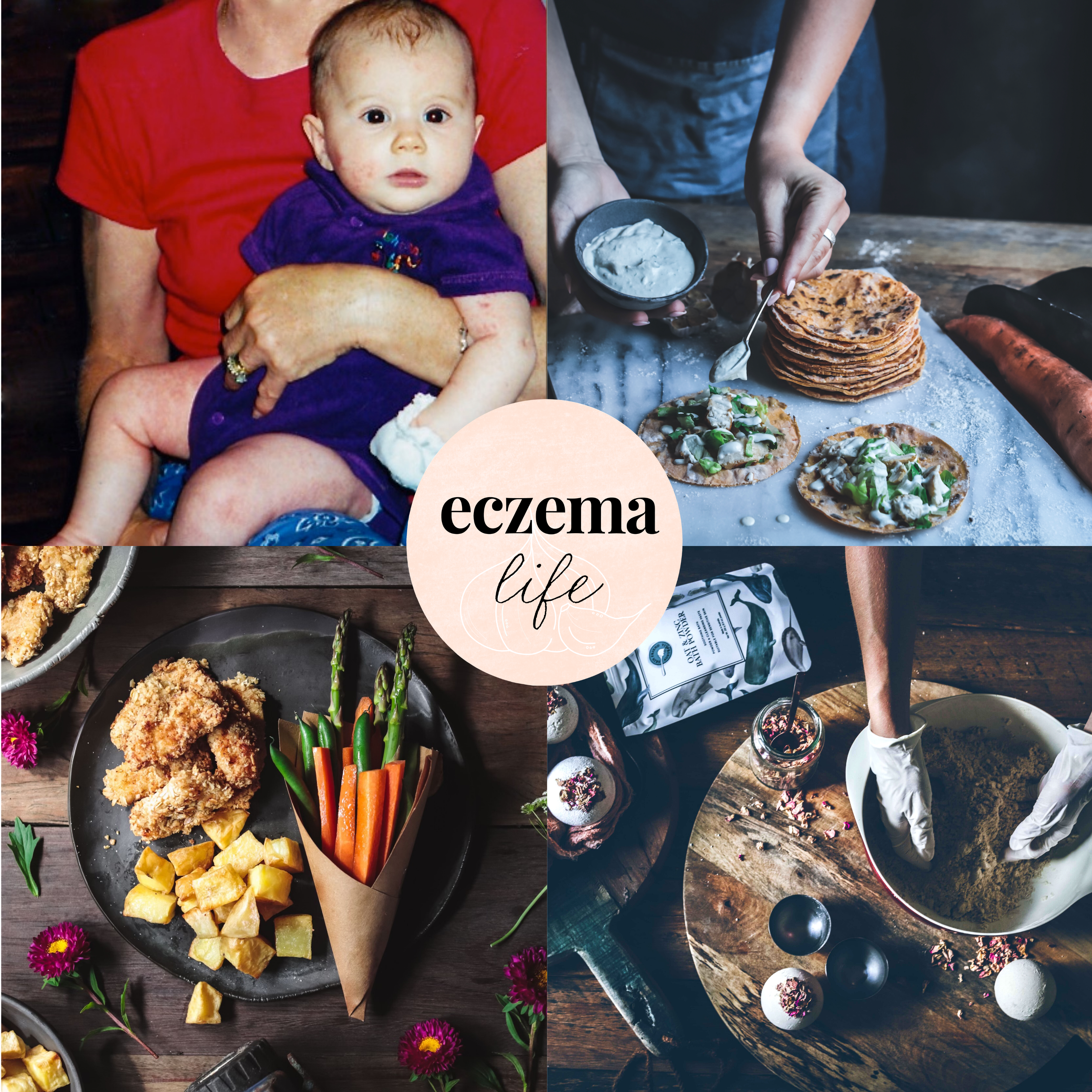 Eczema Life Before & After (our success stories)