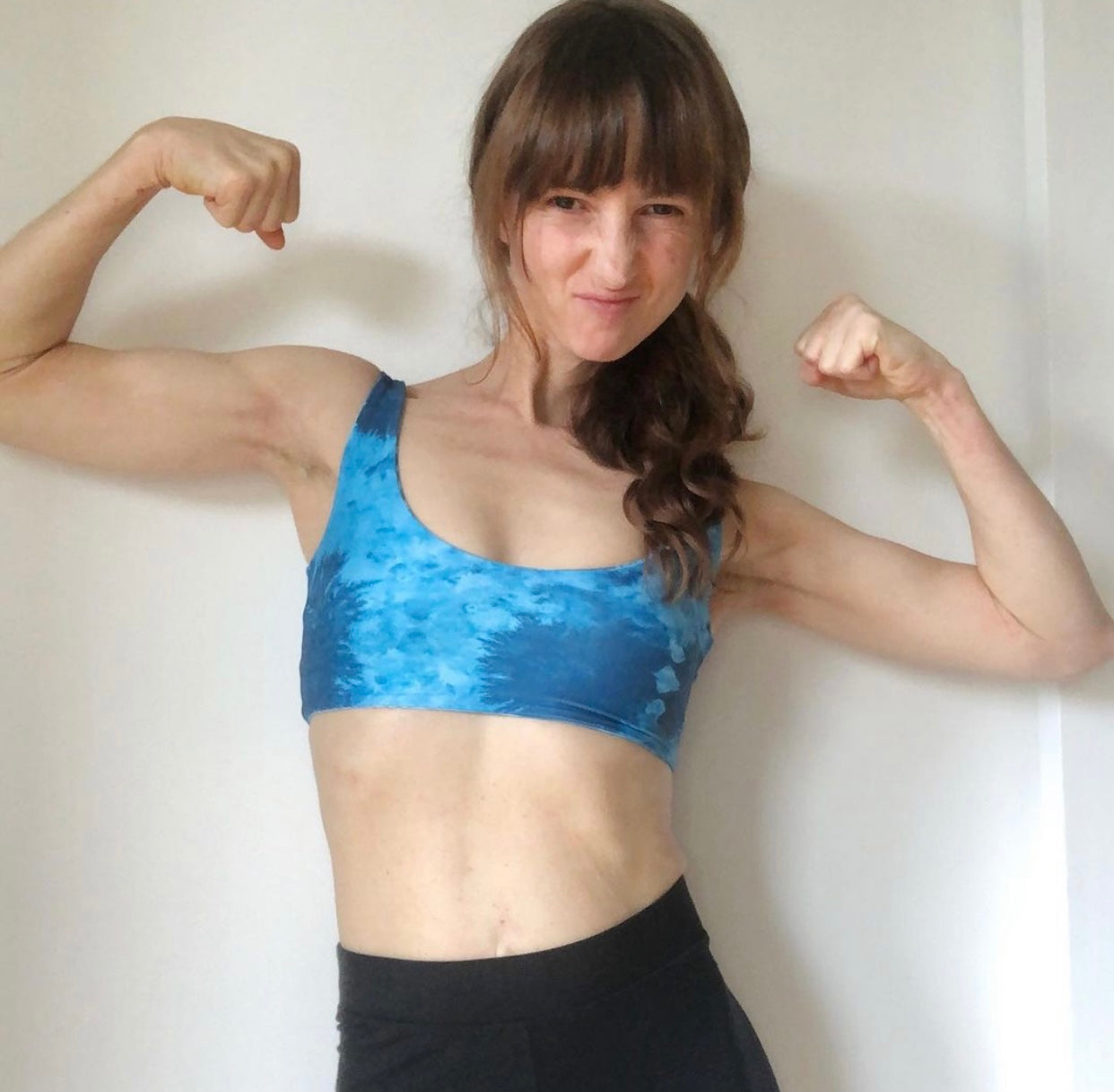 My Eczema Hurt Like Acid: This Helped When Nothing Else Worked