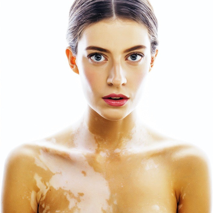 Skin Disorders, Causes & Treatments