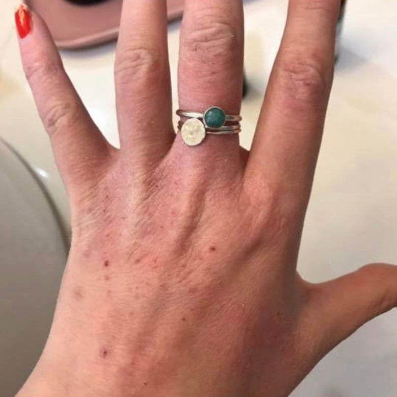 Hand Eczema - My Recovery During Covid Lockdowns