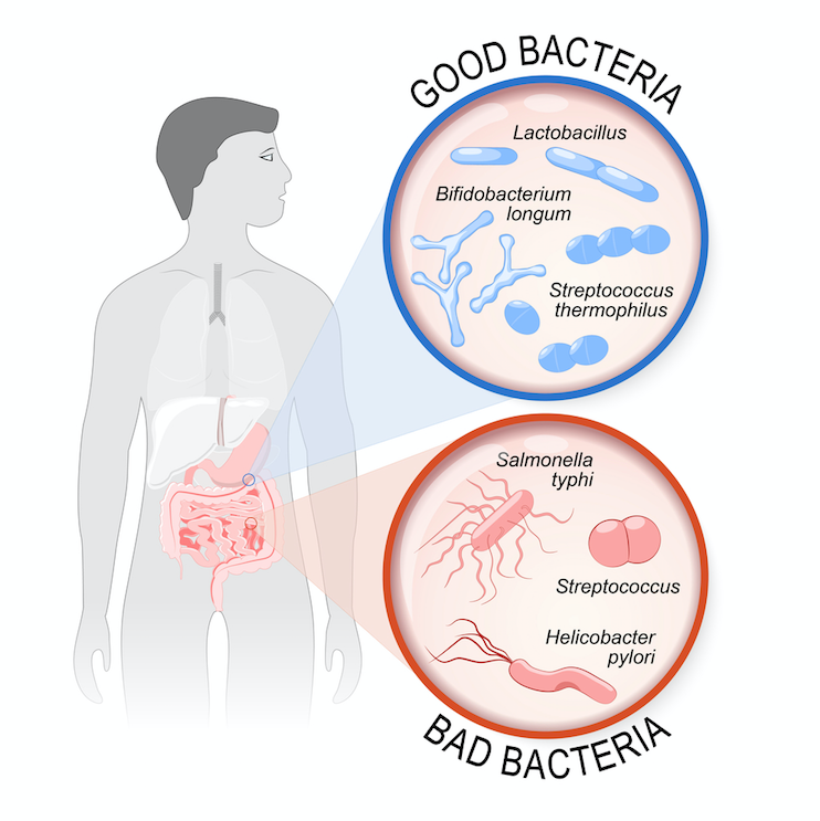 Gut feelings: what happens when your microflora is out of balance?